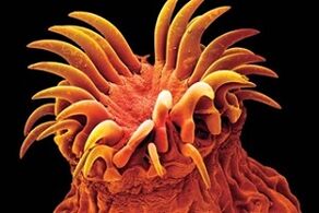 Paraziți trematozi la om