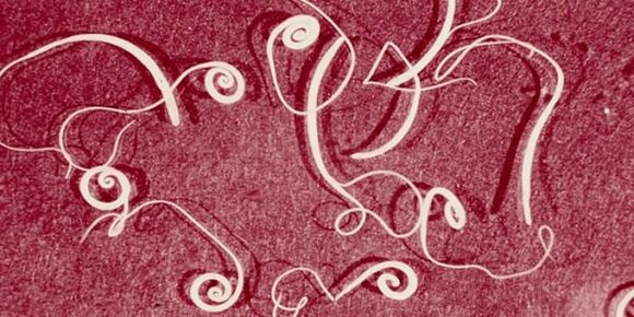 fotografie cu paraziți umani