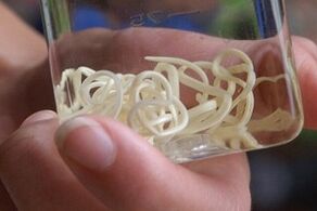 paraziți din corpul uman