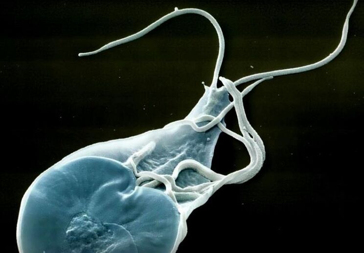 lamblia intestinală la om